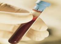 无菌脱纤维兔血