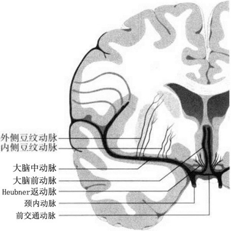 大脑半球冠状位显示大脑中动脉主干及其分支豆纹动脉