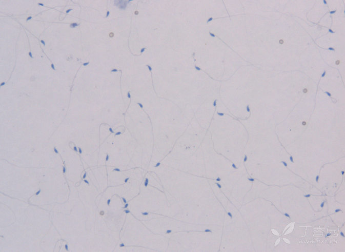 关于精子涂片如何制备,如何保存涂片