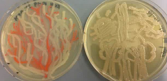 脱硫弧菌脱硫亚种（脱硫微螺菌、脱硫螺菌、脱硫杆菌、脱硫芽孢弧菌、脱硫弧菌）