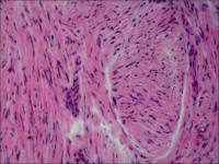 牛肺血管内皮细胞 CPAE
