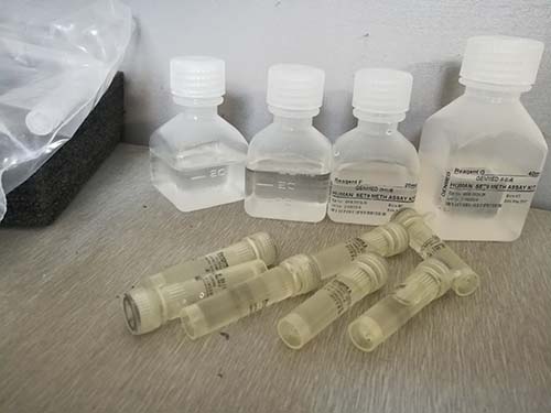冰冻切片组织衰老晚期特异性脂褐素碱性品红（ZIEHL-NEELSEN）原位染色试剂盒