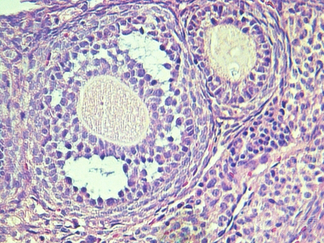 求教,大神帮我看一下,这几张卵巢he染色切片上能看到炎症细胞的浸润么