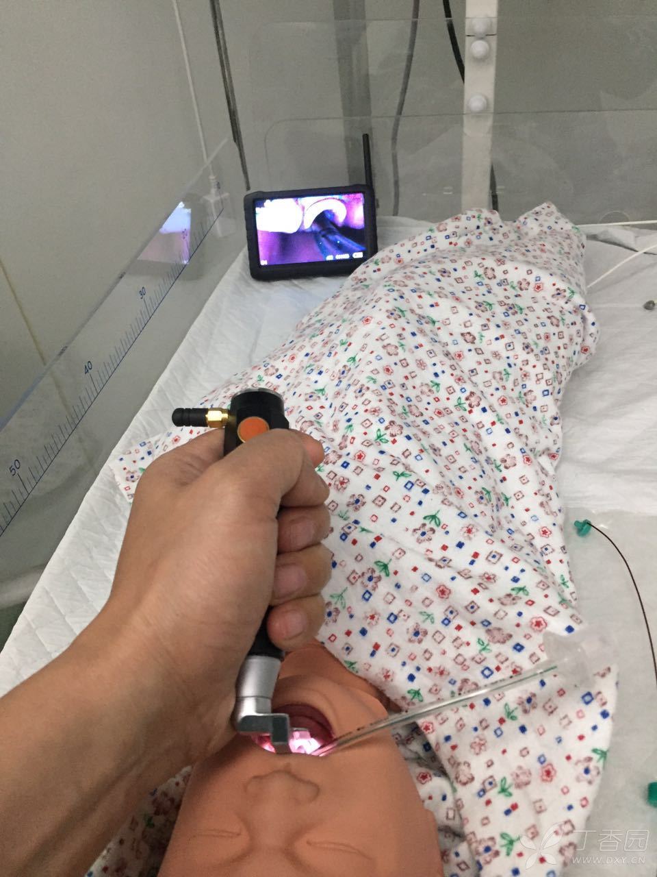 新生儿全麻或复苏用无线可视喉镜