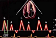 心脏 Tei 指数：进食如何影响超声测值