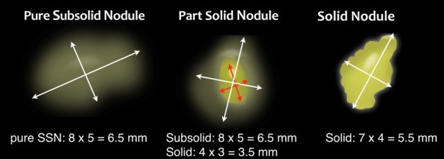 a551578a8e7a96_7-measurement.png