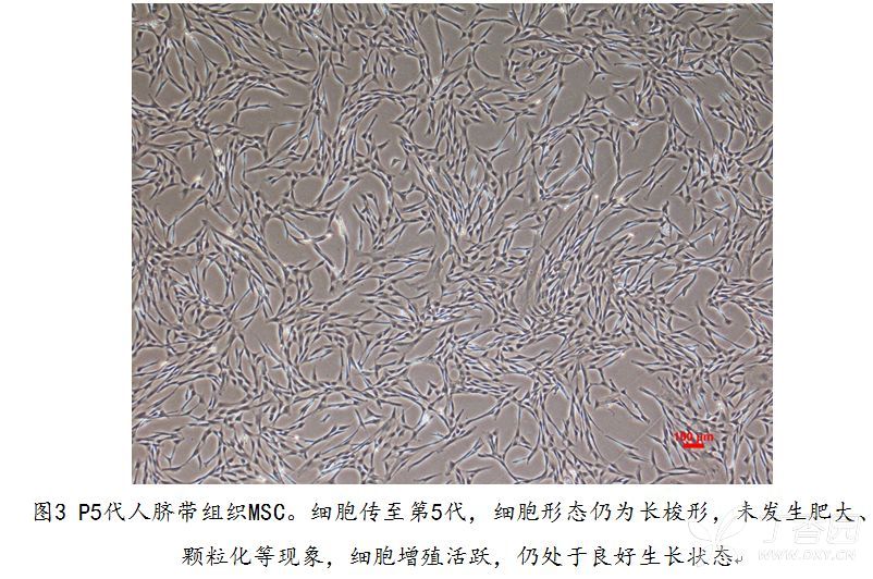 培养的间充质干细胞msc,大家看一下这是什么?
