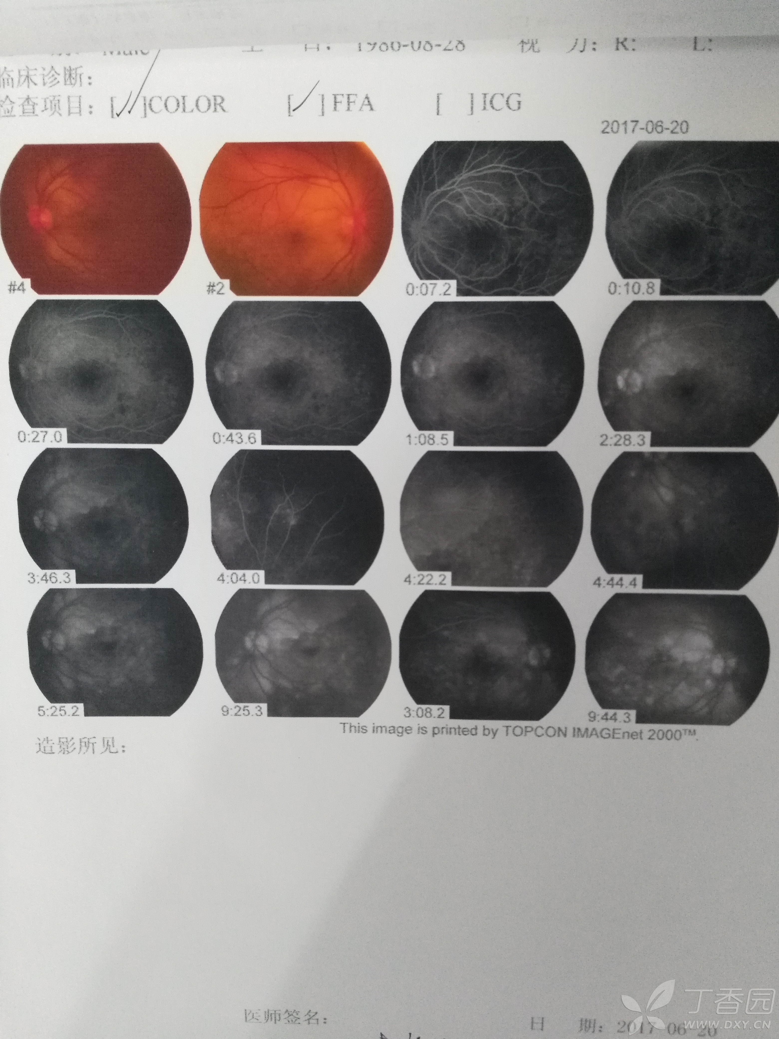 眼科专业讨论版 -丁香园论坛