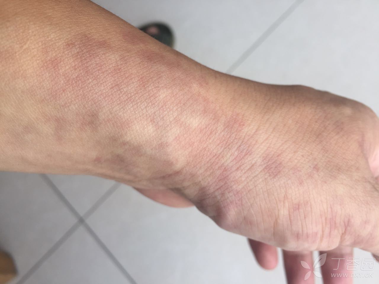 这"血斑"看了将近四十年!有哪位大侠指点下?谢谢!