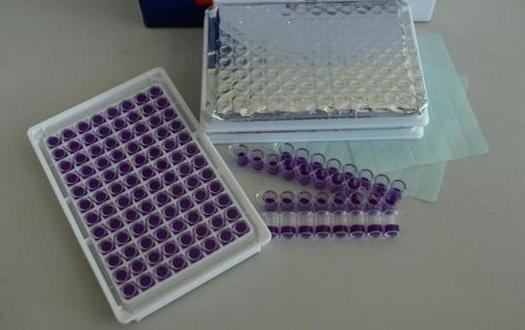 人抗天然脱氧核糖核酸抗体(n-DNA-Ab)ELISA试剂盒价格 