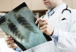 除肺炎外，Nivolumab 还会引起肺癌假性进展