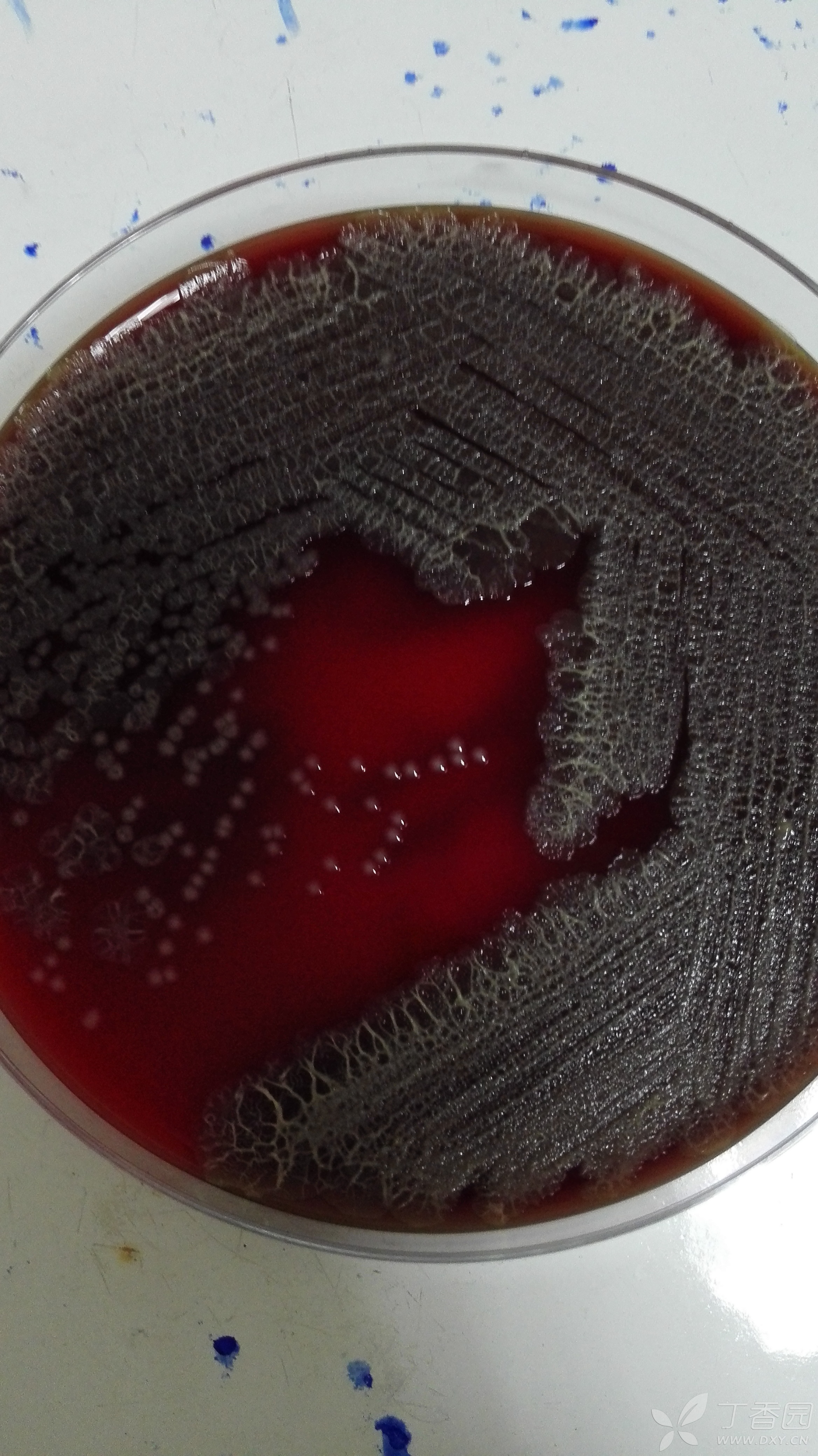 请微生物的老师帮忙看看,为什么这个大肠埃希菌的菌落是这样的