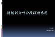 精彩幻灯：肺解剖分叶分段 CT 示意图