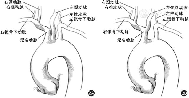 牛的大动脉示意图图片