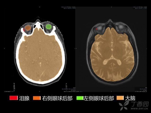 头颈部断层解剖图 头颈部超薄 CT／MRI 断层图谱，收藏没商量