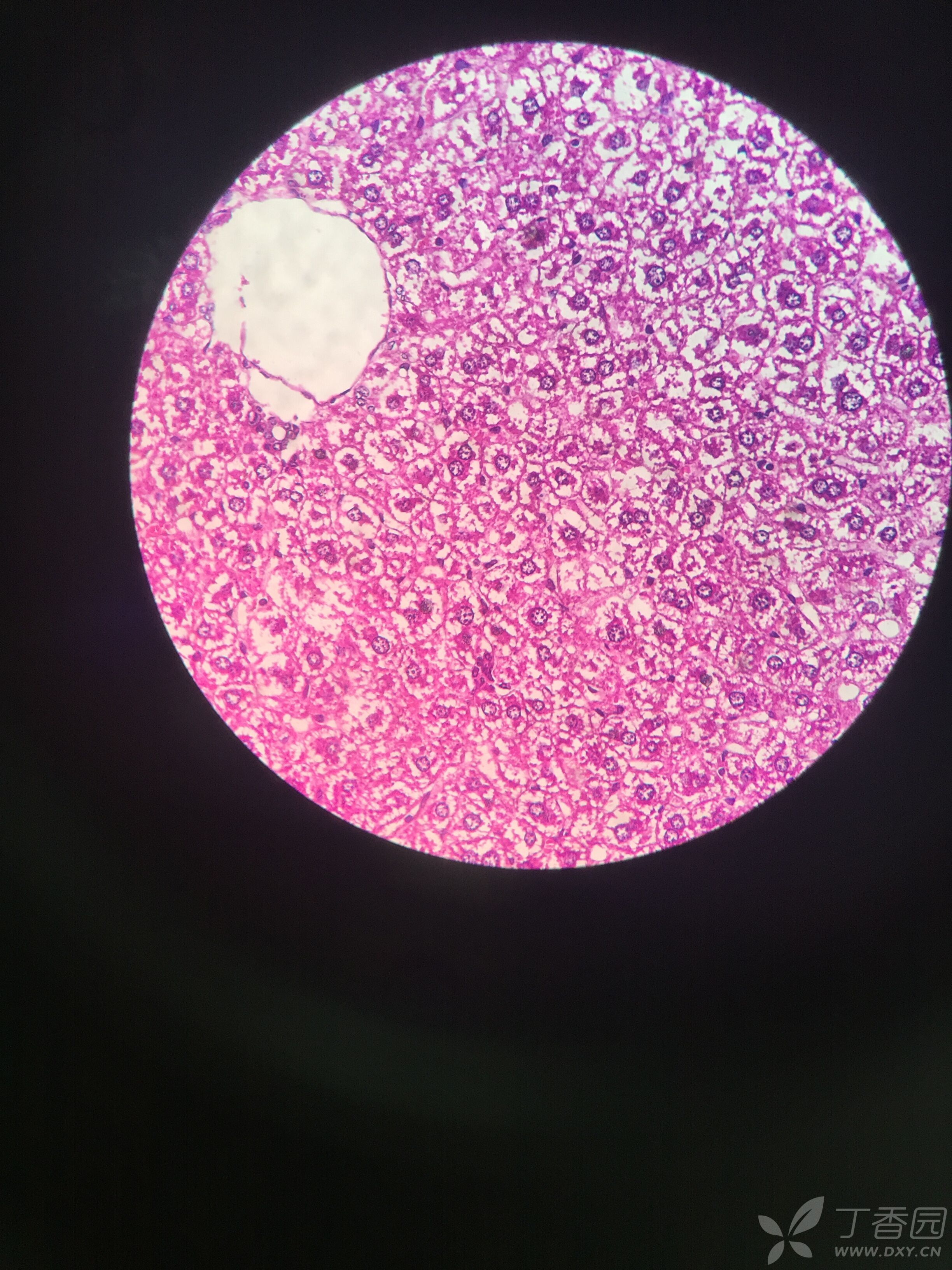 肝细胞切片图图片