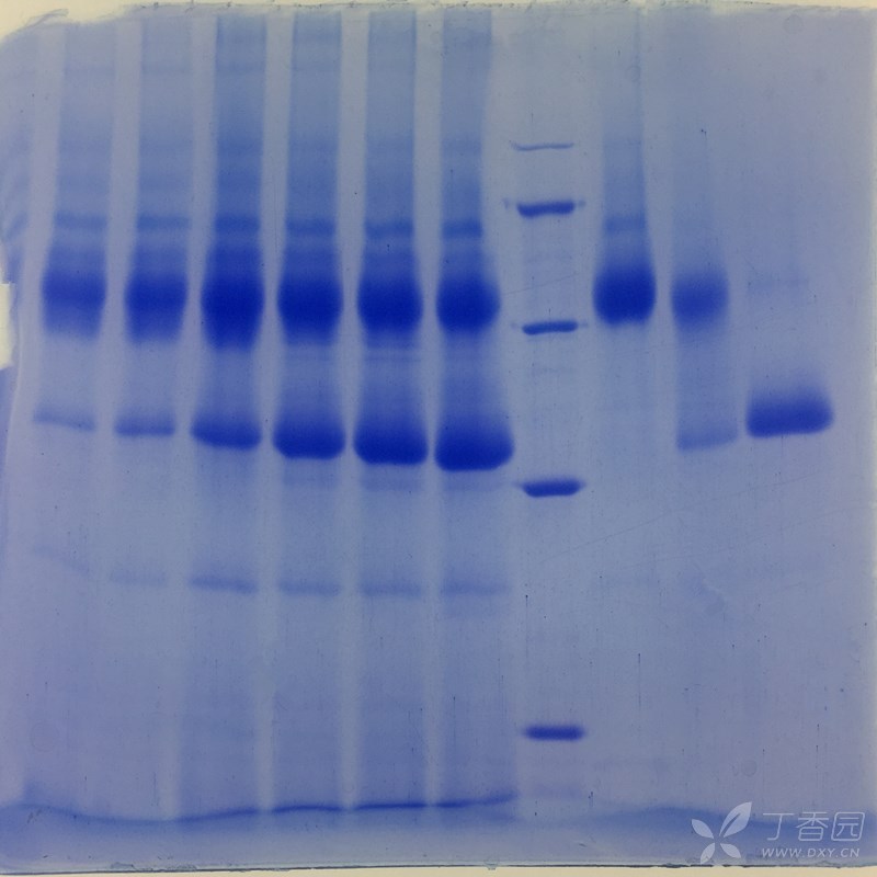 请教各位,看看我跑的胶有什么问题,怎么跑的好看些.