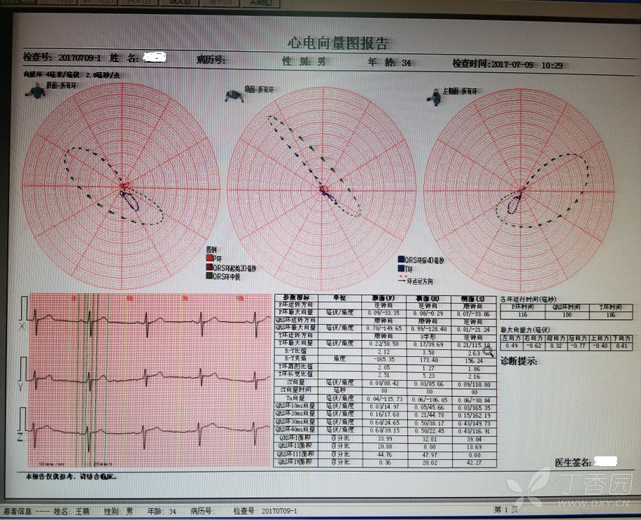 心电向量图图解 报告图片
