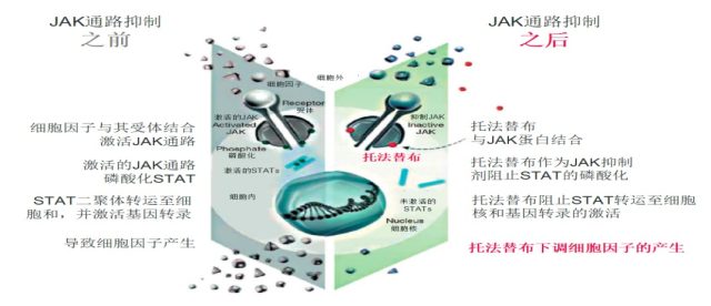 托法替布 1分钟了解托法替布在 RA 医治中的价值