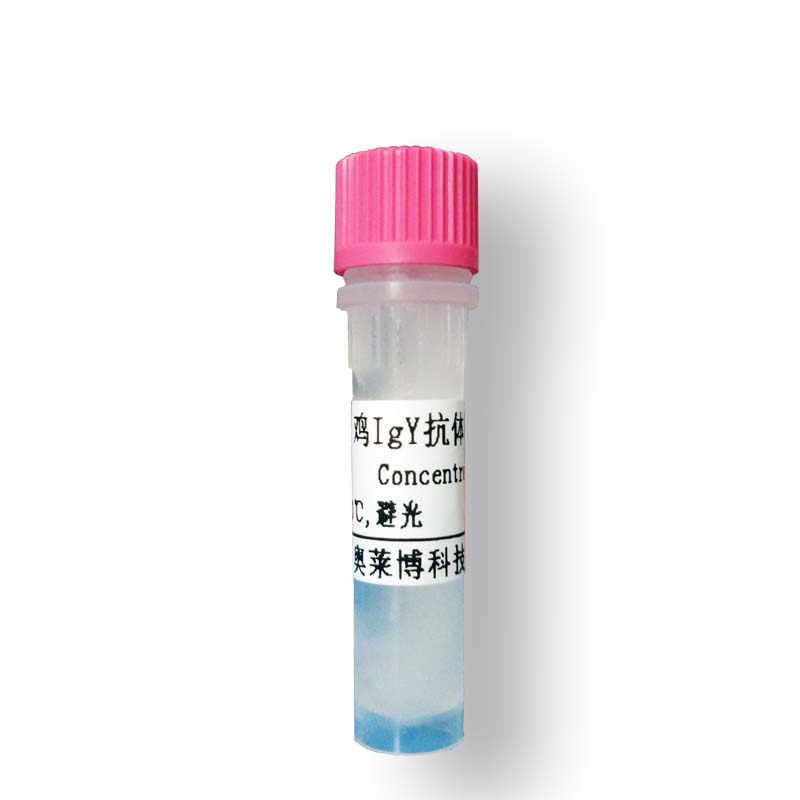北京兔抗IDH1抗体(异柠檬酸脱氢酶抗体)价格