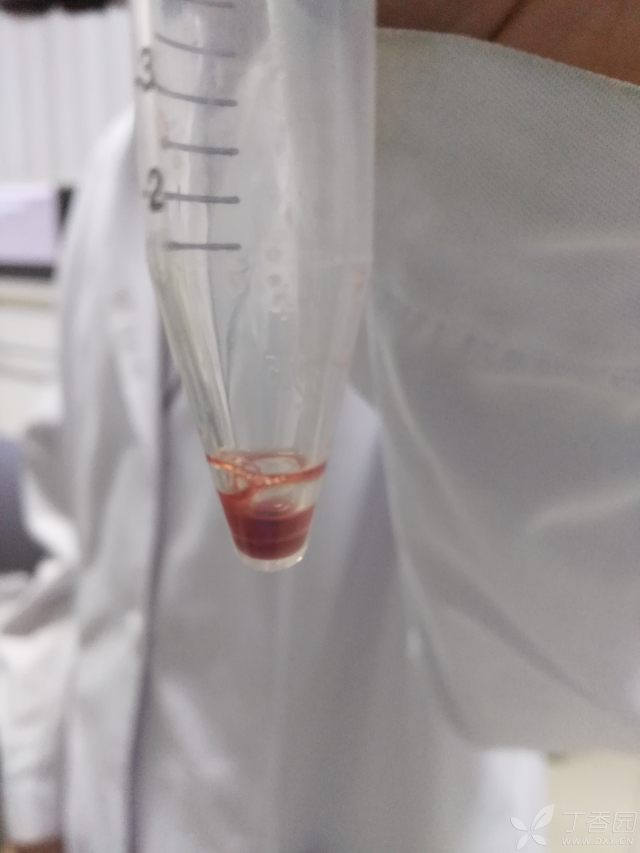 YangHJ7 的个人主页 - 丁香园 - 医学交流社区,分享临床经验、病例讨论、考试科研、求职晋升经验