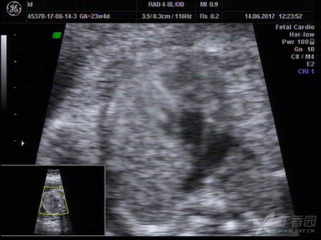 3224978494154430383-8w.jpg!w640