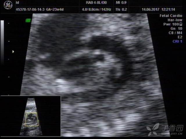 3224978494154400377-8w.jpg!w640