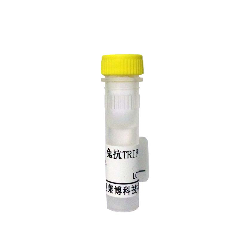 兔抗人IgM抗体(RBITC标记) RBITC标记抗体