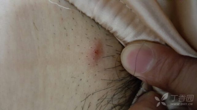 3225215907061631733-16w.jpg!w640