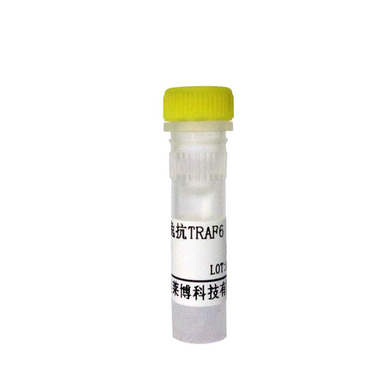 山羊抗人IgG(H+L)抗体(BIOTIN标记)厂家价格