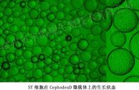 ST细胞在CephodexD型微载体上的生长状态