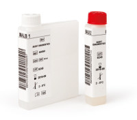 结珠蛋白(Hp)测定试剂盒