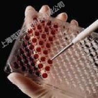 猴可溶性细胞间粘附分子1(sICAM-1)酶联免疫试剂盒