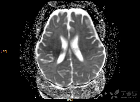 3225857467801486106-8w.jpg
