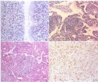 免疫组化实验技术服务
