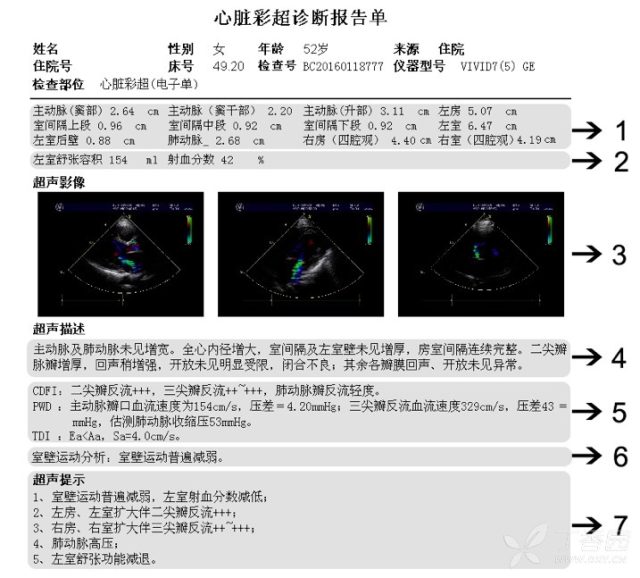 图1-1 超声心电图报告格式示意图.png