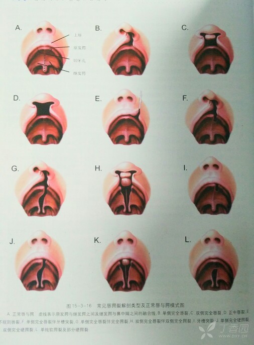 嘴唇解剖结构层次图片图片