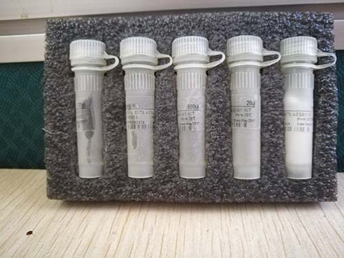 河流弧菌核酸检测试剂盒（恒温荧光法）