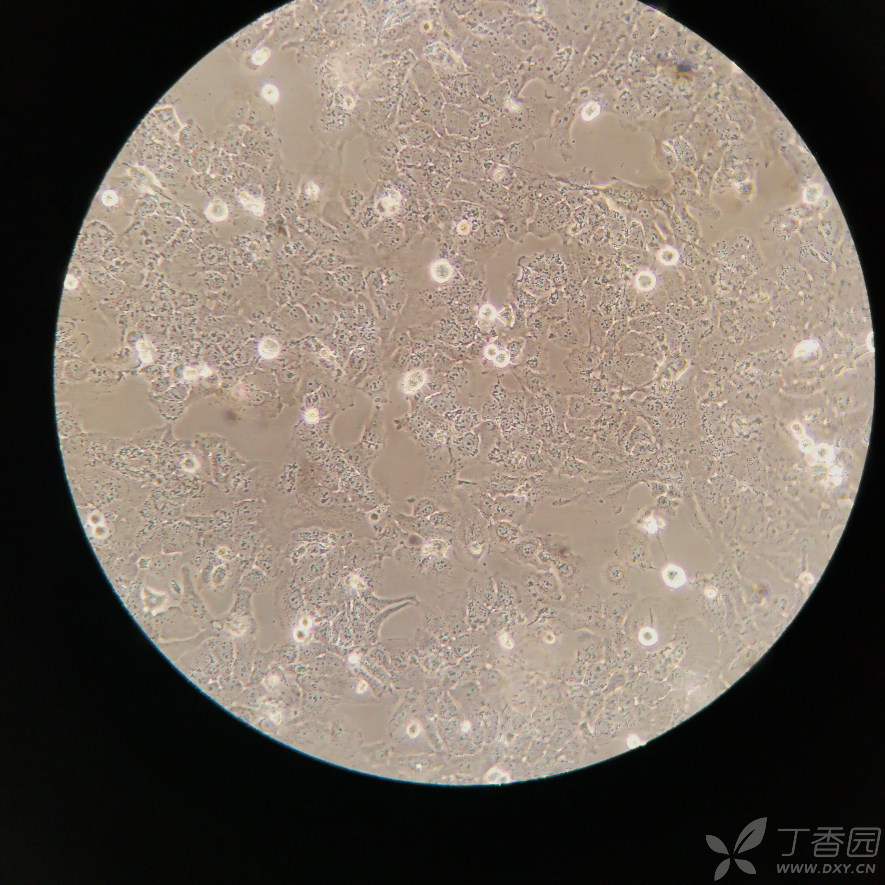 hep g2长成这个鬼样子,求经验指导