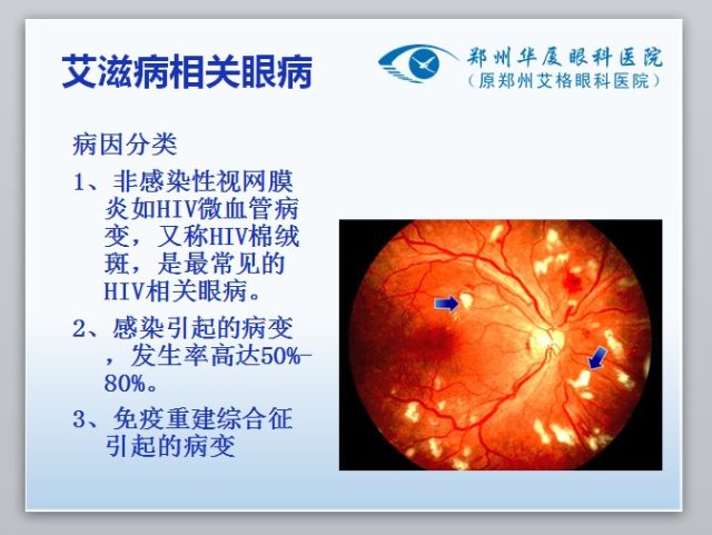 眼科专家门愿如：艾滋病玻璃体视网膜病变的手术治疗
