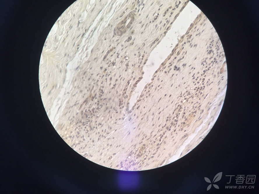 破骨细胞trap染色鉴别?