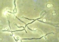 微生物切片厂家直供教学优质高教病理组织白色念球菌切片大量批发