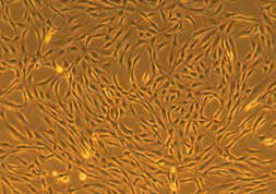 ATCC 细胞 Adipose-Derived Mesenchymal Stem Cells; Normal, Human (ATCC® PCS-500-011™) 