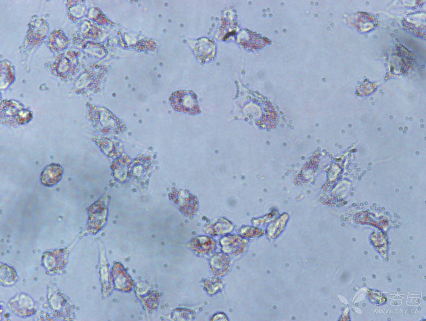潘氏细胞染色图片