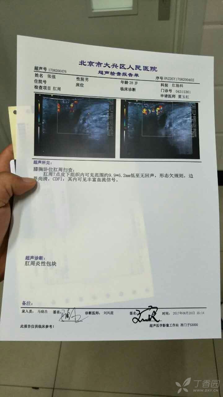 保險怎麼報銷 肛周膿腫住院手術保險可以報銷