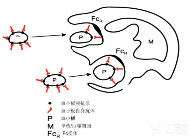 这个患儿的血小板为0 丁香园