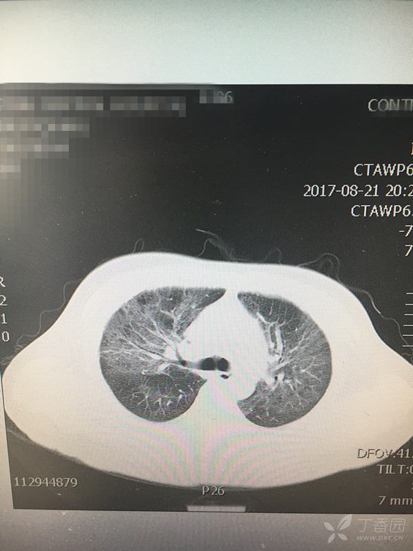 大家一起来看看这个肺CT是什么病?一周后揭晓