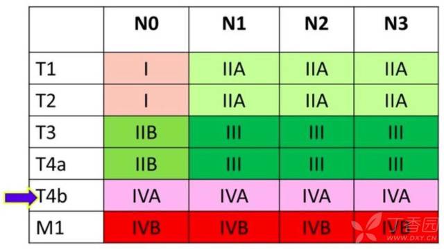 第 8 版胃癌 TNM 分期即将实施，这 3 个更新要点需知晓 - 丁香园