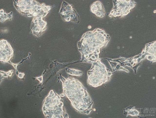 3229816738306155045-8w.jpg!w640