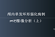 颅内单发环形强化病例MRI影像分析（上）